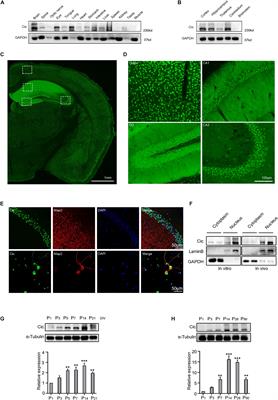 Capicua Regulates Dendritic Morphogenesis Through Ets in Hippocampal Neurons in vitro